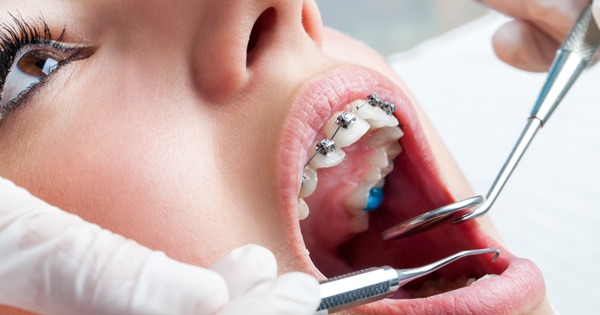 Tratamientos de ortodoncia